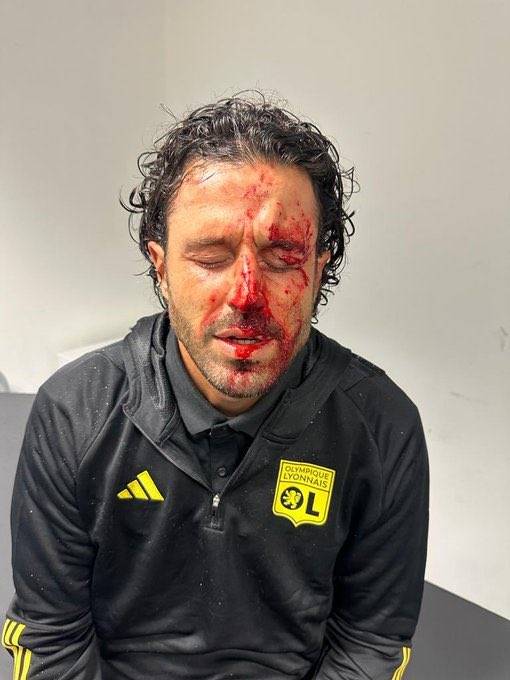 Marsilya taraftarı saldırdı:  Lyon'un teknik direktörü Fabio Grosso'nun son hali ortaya çıktı 7