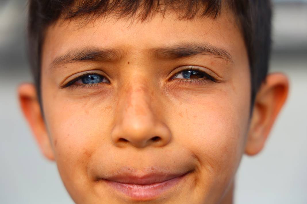 9 yaşındaki çocuğun gözleri herkesi büyüledi! Biri mavi biri kahve 2