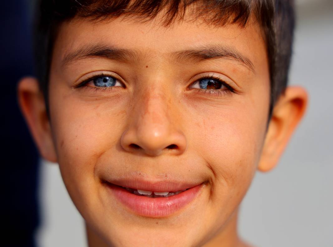 9 yaşındaki çocuğun gözleri herkesi büyüledi! Biri mavi biri kahve 3