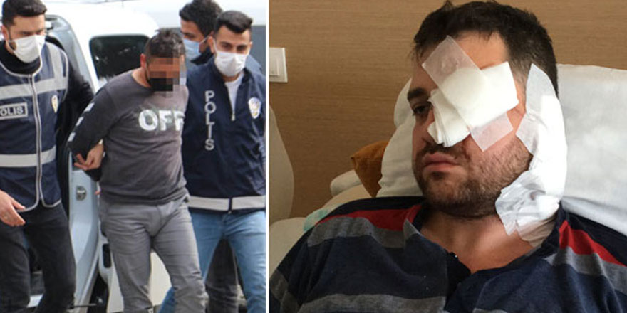 Avukat Asilcan Tuzcu'yu bıçakla saldırıp kör eden kişi, müvekkilin kocası çıktı