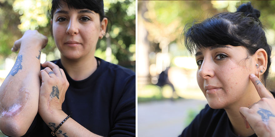 Döner bıçağı ile yaralanan Gizem Çiçekalan: Ölmek istemiyorum
