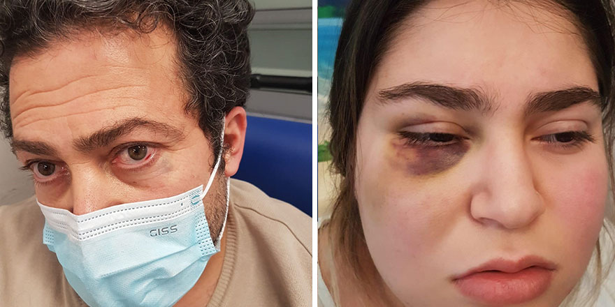 Almanya polisi Türk Cemil Başöngen ve kızına şiddet uyguladı!