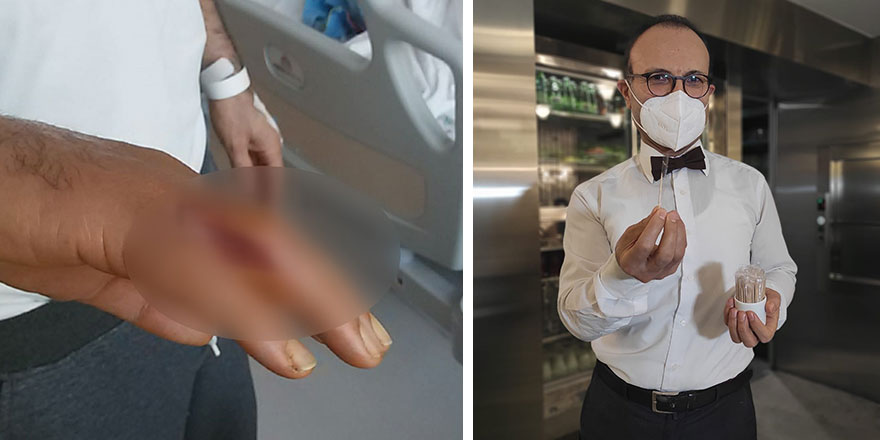 İsrafil Türkmen'in eline kürdan battı! Hayatı kabusa döndü
