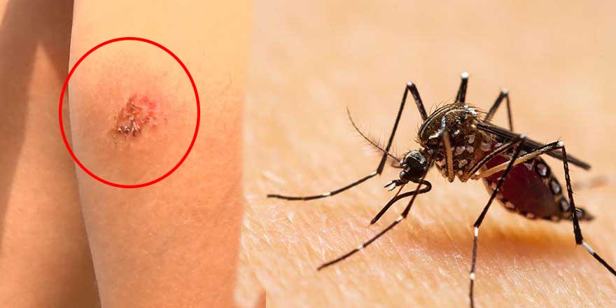 Uzmanlardan  ‘Asya Kaplan Sivrisineği’ uyarısı!