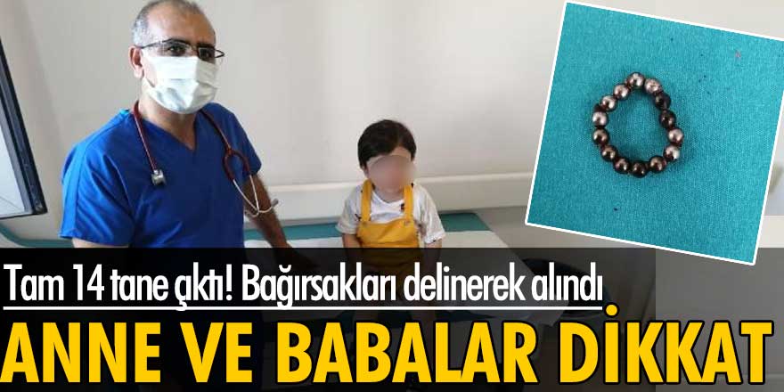 Batman'da 20 aylık Ahmet Arif Ataş'ın yuttuğu 14 mıknatıs bağırsakları delinerek alındı