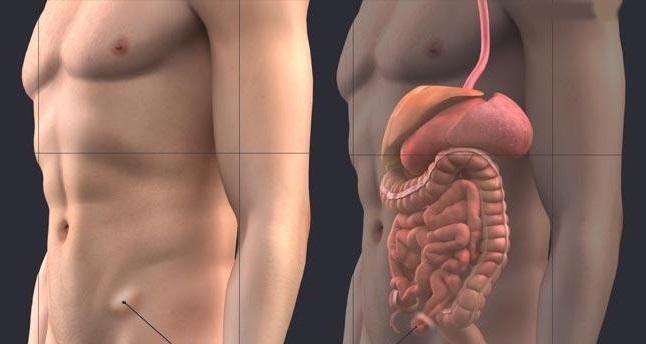 Op.Dr. Faydacı: Tedavi edilmeyen kasık fıtığı organlara zarar verebiliyor