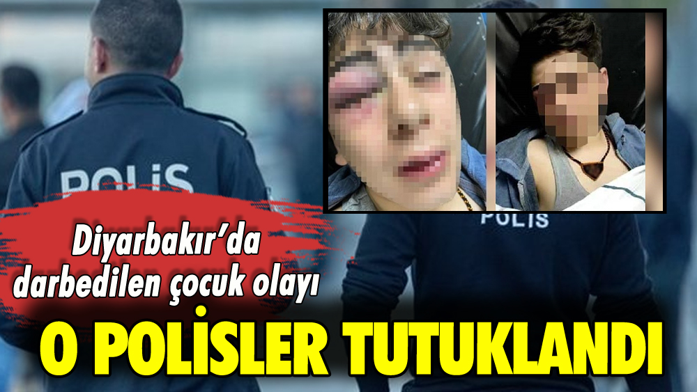 Diyarbakır'da çocuğa darp: O polisler tutuklandı