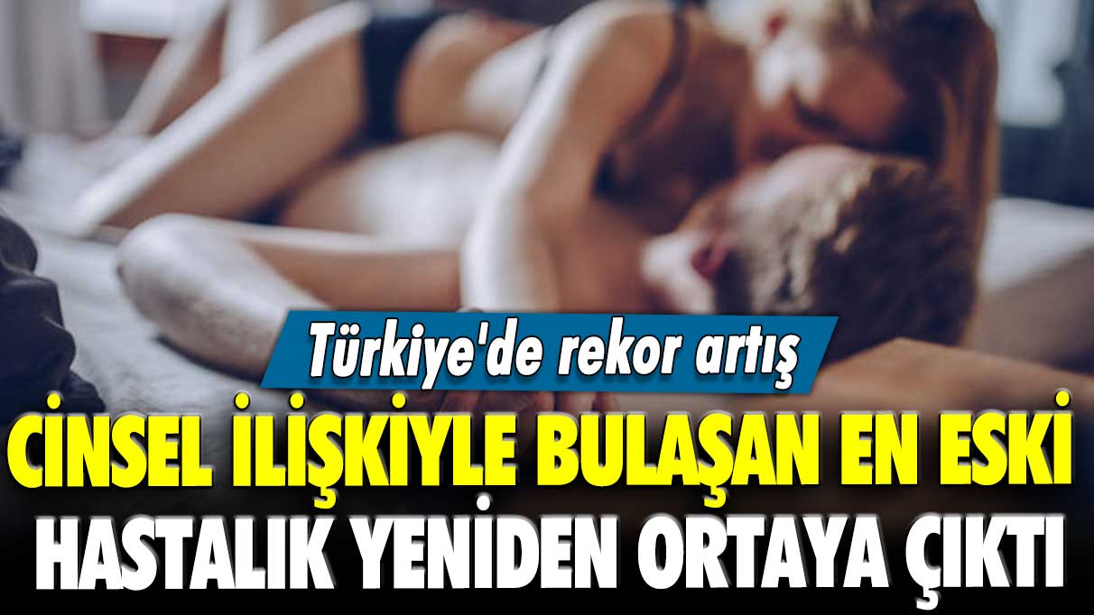 Cinsel ilişkiyle bulaşan en eski hastalık yeniden ortaya çıktı: Türkiye'de rekor artış