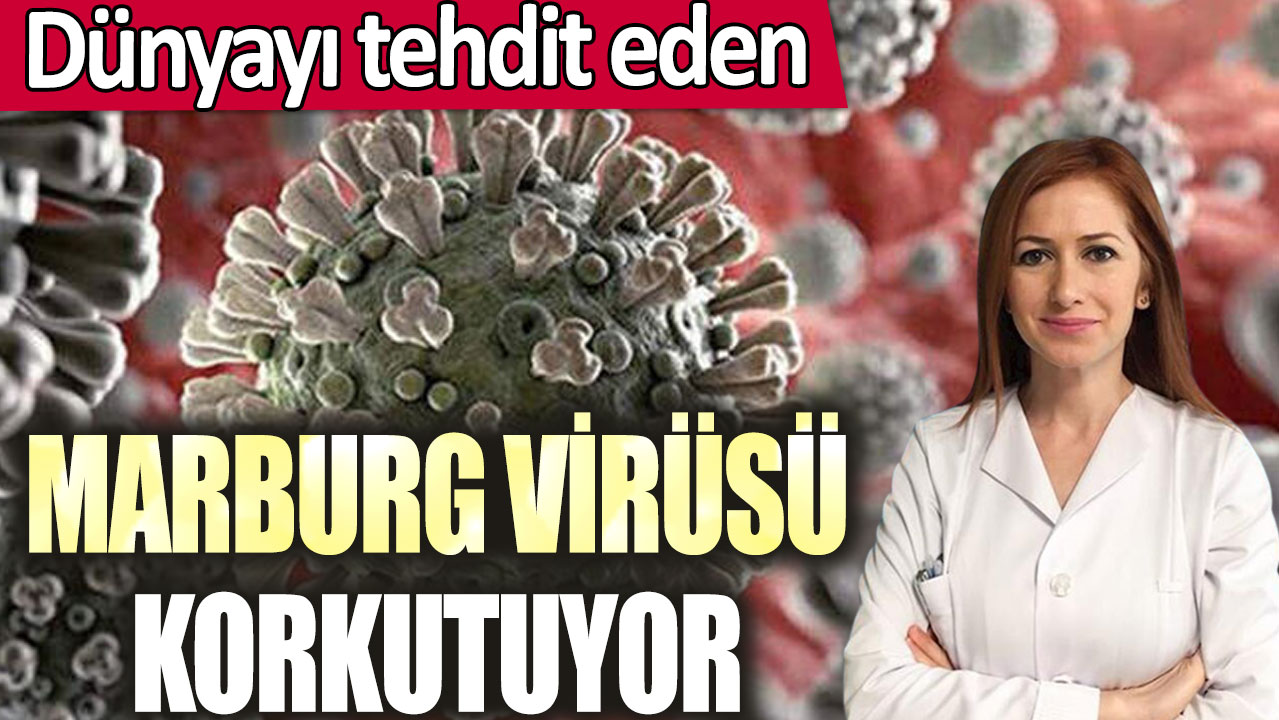 Dünyayı tehdit eden Marburg virüsü korkutuyor!