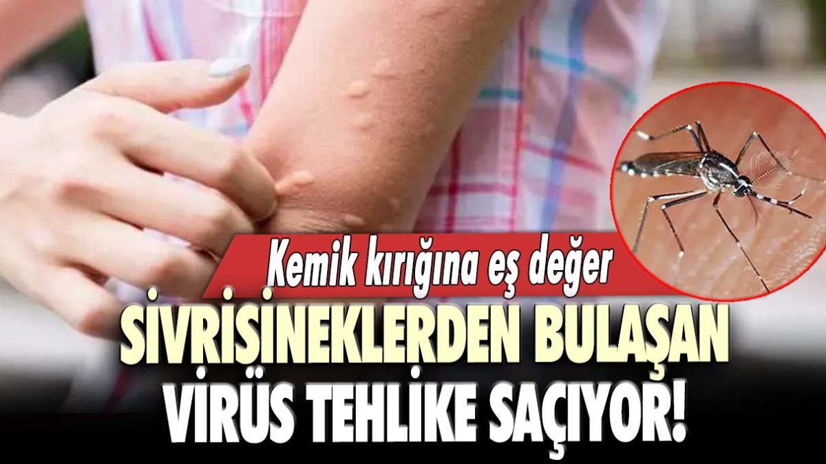 Sivrisineklerden bulaşan virüs tehlike saçıyor! Kemik kırığına eş değer