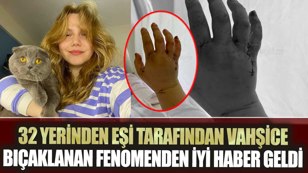 32 yerinden eşi tarafından vahşice bıçaklanan fenomen Merve Veziroğlun'dan iyi haber geldi