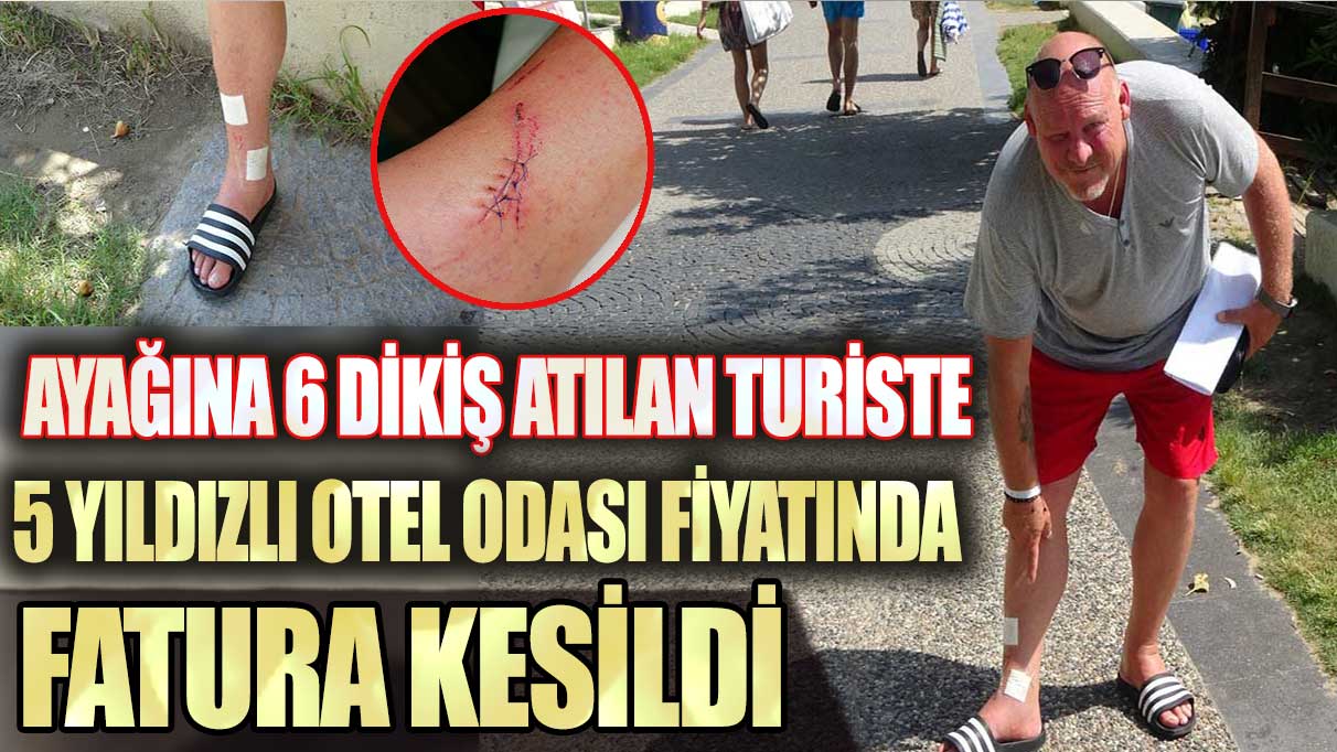 Antalya’da ayağına 6 dikiş atılan turiste 5 yıldızlı otel odası fiyatında fatura kesildi
