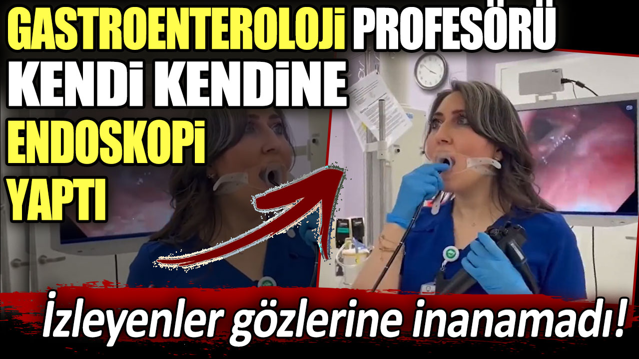 Gastroenteroloji profesörü kendi kendine endoskopi yaptı: İzleyenler gözlerine inanamadı