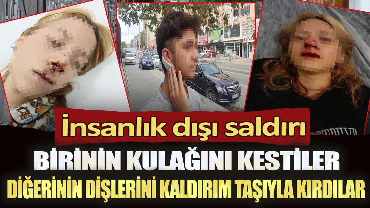 Sultangazi’de insanlık dışı saldırı: Birinin kulağını kestiler diğerinin dişlerini kaldırım taşıyla kırdılar