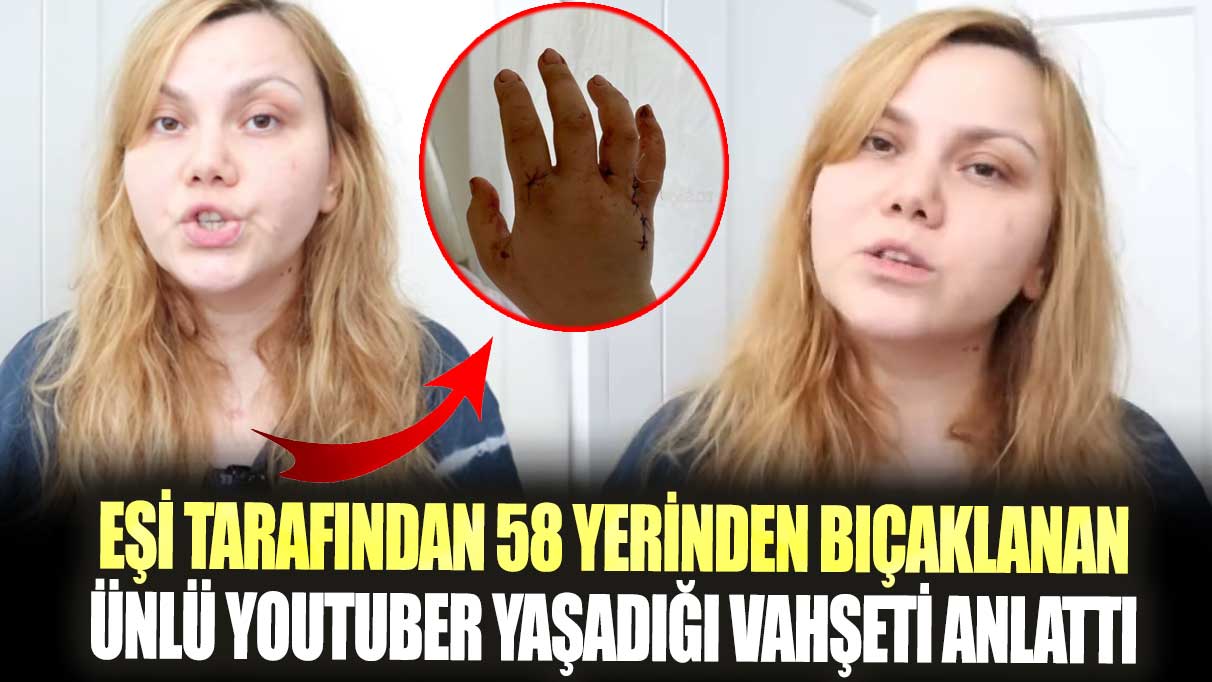 Eşi tarafından 58 yerinden bıçaklanan ünlü Youtuber Merve Veziroğlu yaşadığı vahşeti anlattı