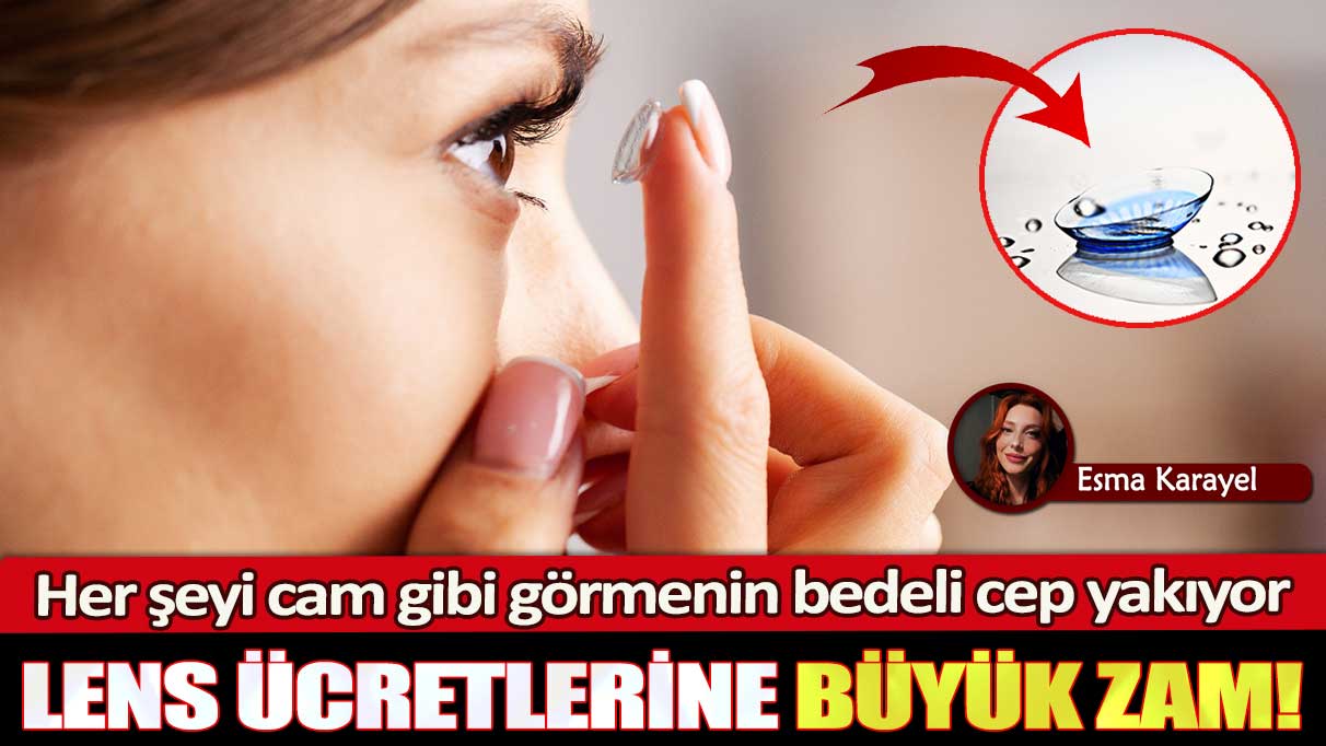 Lens ücretlerine büyük zam: Her şeyi cam gibi görmenin bedeli cep yakıyor