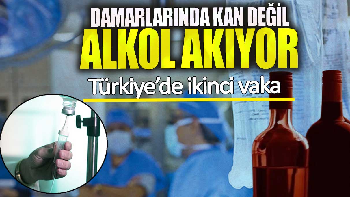 Türkiye’de ikinci vaka! Damarlarında kan değil alkol akıyor