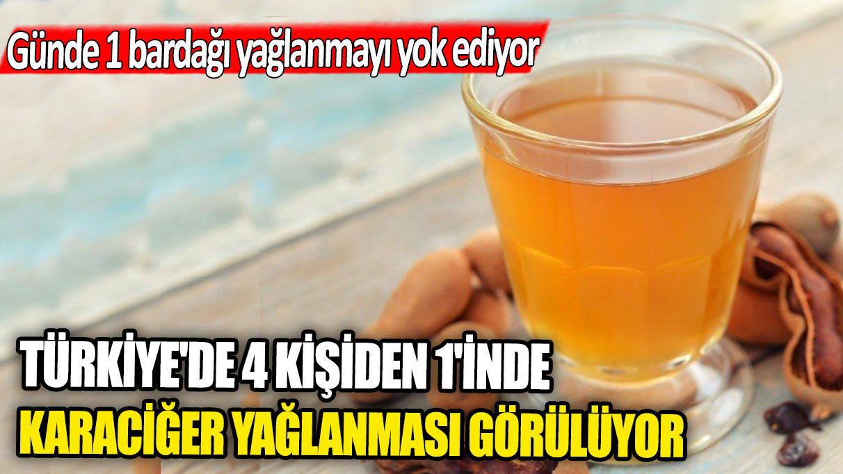 Türkiye'de 4 kişiden 1'inde karaciğer yağlanması görülüyor! Günde 1 bardağı yağlanmayı yok ediyor
