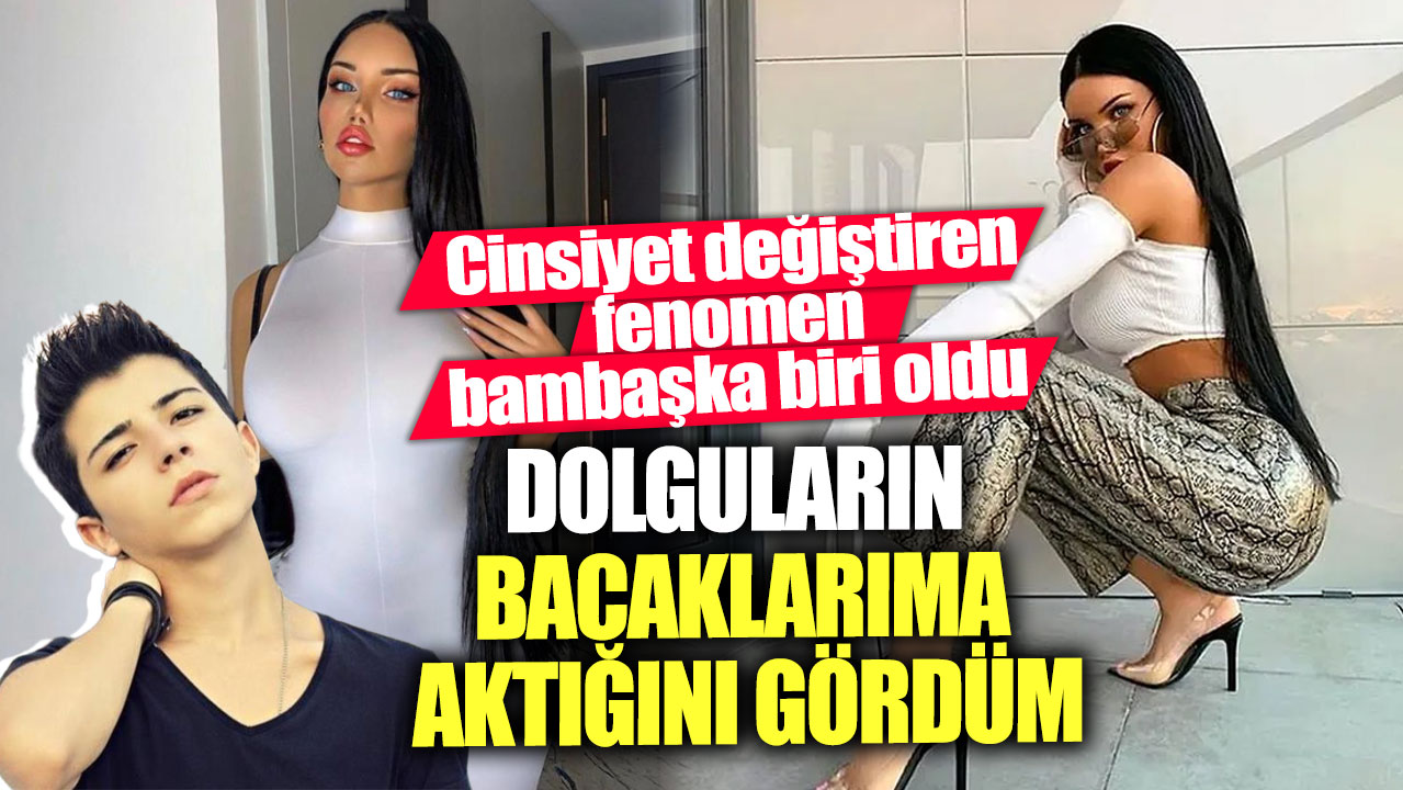 Cinsiyet değiştiren fenomen Beren Güney bambaşka biri oldu! Dolguların bacaklarıma aktığını gördüm