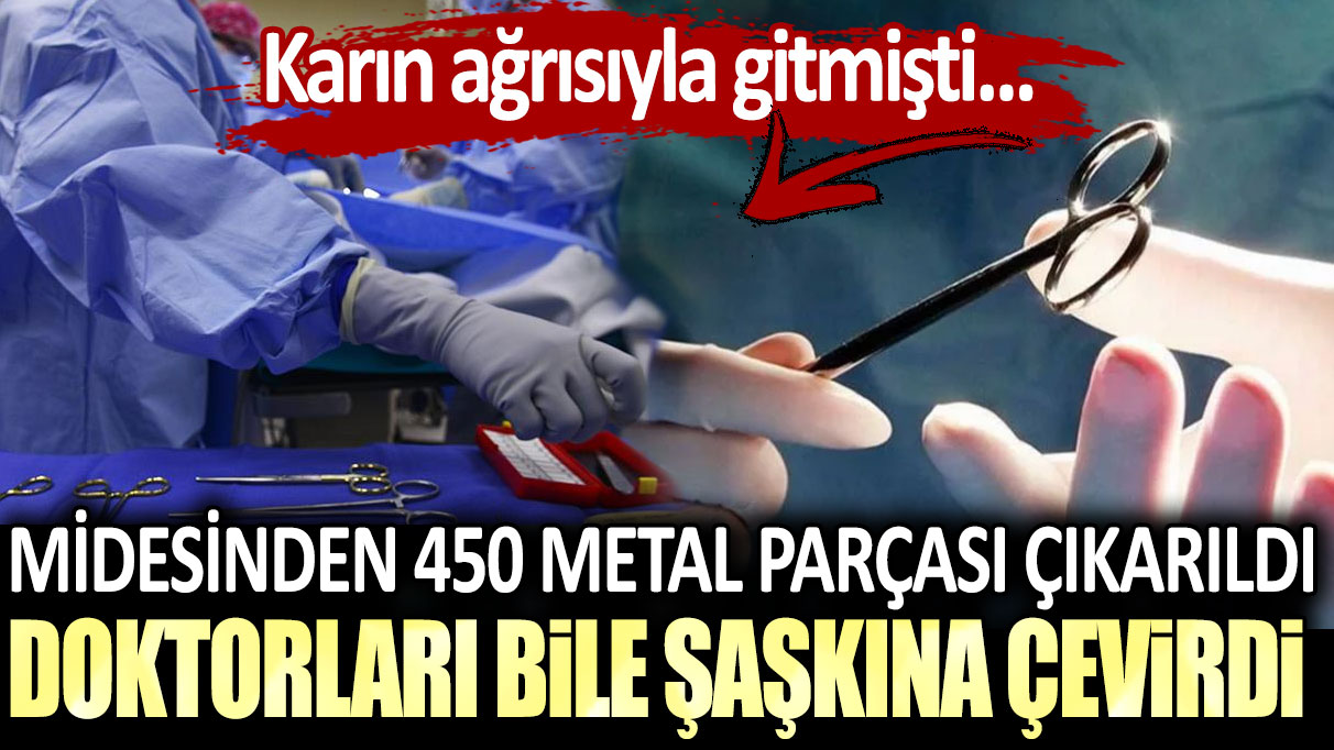 Midesinden 450 parça metal çıkarıldı. Doktorları bile şaşkına çevirdi