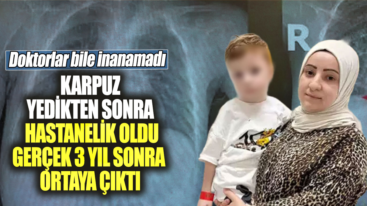 Karpuz yedikten sonra hastanelik oldu. Gerçek 3 yıl sonra ortaya çıktı