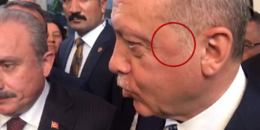 Tayyip Erdoğan'ın başındaki detay merak edildi!