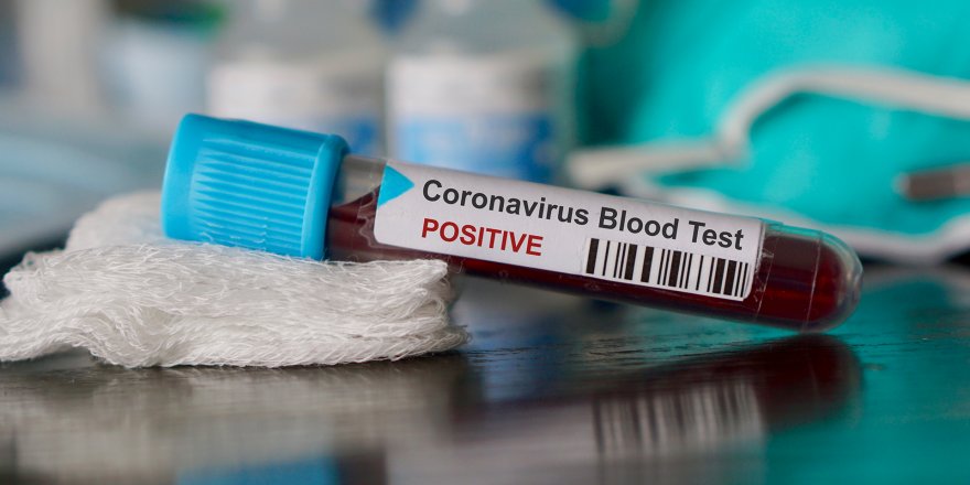 'Coronavirüs biyolojik silah mı?' sorusuna Türk uzmandan yanıt!