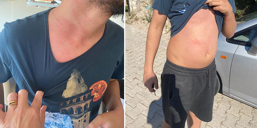 İzmir'de kargocu "terörü": Küfür etti, darp etti, elini kolunu sallayarak evine gitti