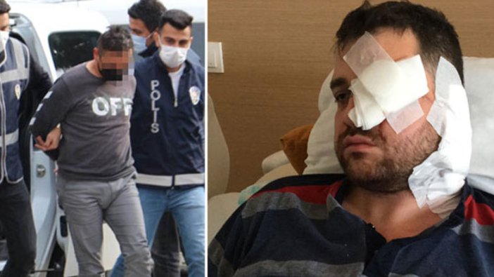 Avukat Asilcan Tuzcu'yu bıçakla saldırıp kör eden kişi, müvekkilin kocası çıktı