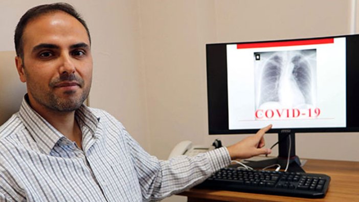 Murat Canayaz'dan, röntgen filmlerden koronavirüs teşhisi!