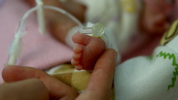 Her yıl 15 milyon bebek prematüre doğuyor