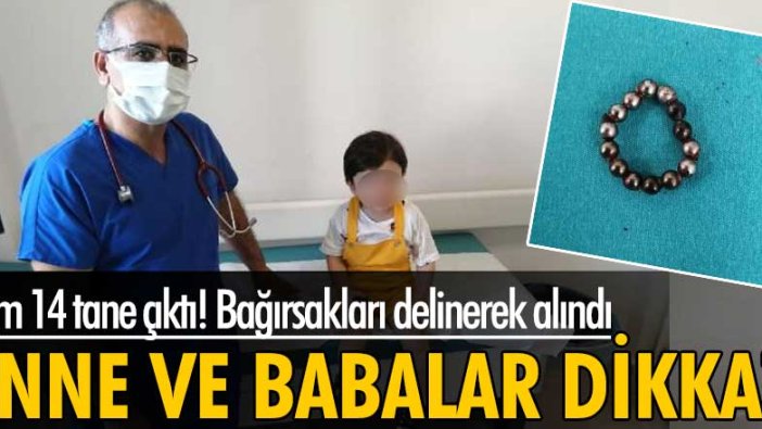 Batman'da 20 aylık Ahmet Arif Ataş'ın yuttuğu 14 mıknatıs bağırsakları delinerek alındı