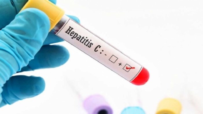 Çin'de 69 hastaya yanlış uygulamalardan hepatit C bulaştı