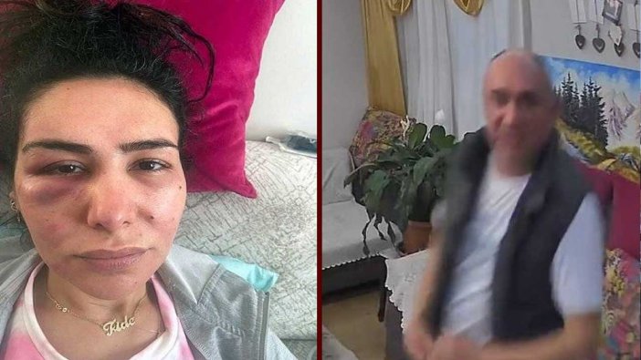 Adana'da cinsel saldırı! Pes dedirten savunma