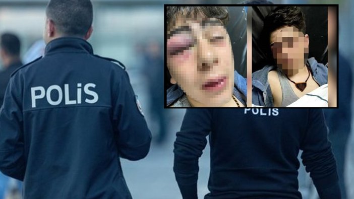 Diyarbakır'da çocuğa darp: O polisler tutuklandı
