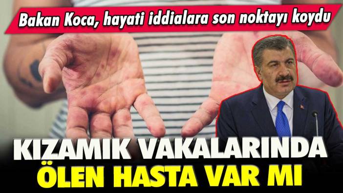 Bakan Koca, hayati iddialara son noktayı koydu: Türkiye’de kızamık vakalarında ölen var mı