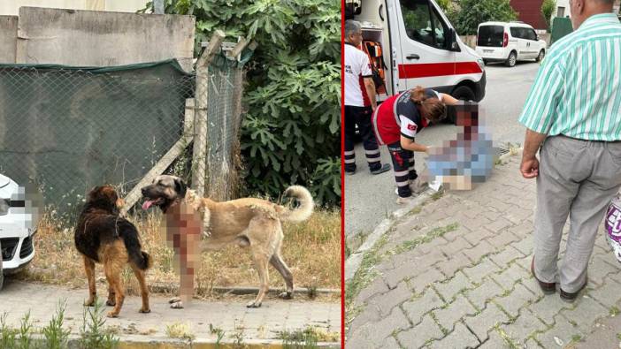 Ataşehir'de köpeğin saldırdığı kadın ağır yaralandı