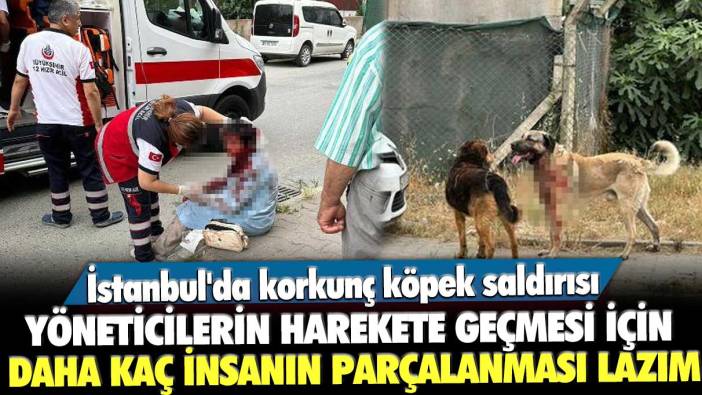 İstanbul'da korkunç köpek saldırısı: Yöneticilerin harekete geçmesi için daha kaç insanın parçalanması lazım