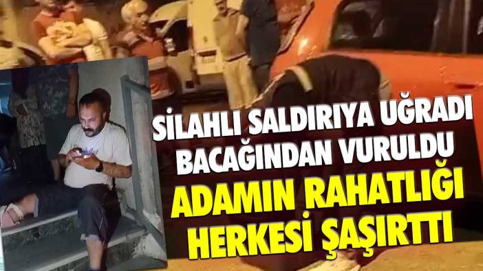 İstanbul'da silahlı saldırıya uğradı, bacağından vuruldu! Adamın rahatlığı herkesi şaşırttı