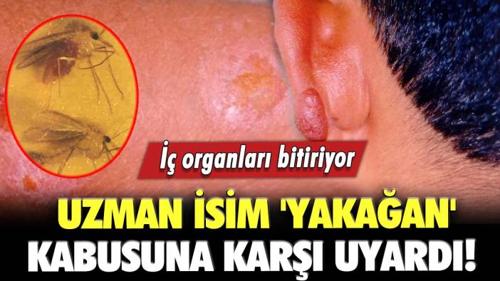 Uzman isim  'Yakağan' kabusuna karşı uyardı!  İç organları bitiriyor