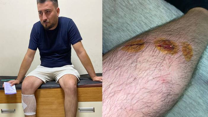 Sokak köpekleri motosikletli gence saldırıp bacağından ısırdı