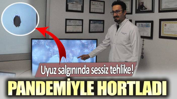 Uyuz salgınında sessiz tehlike! Pandemiyle hortladı