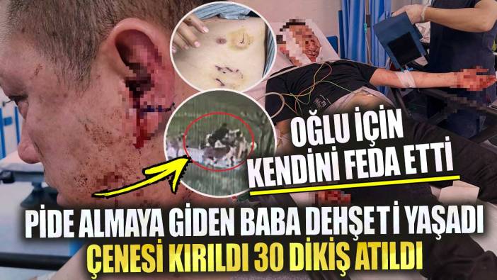 Bursa'da pide almaya giden baba dehşeti yaşadı çenesi kırıldı 30 dikiş atıldı