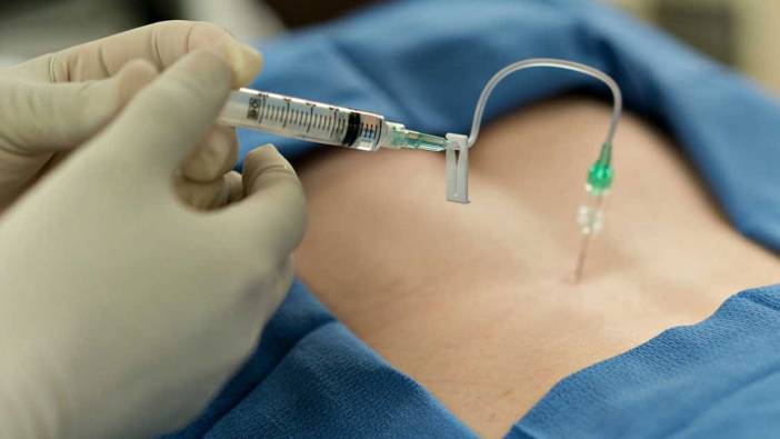 Türkiye’de epidural anestezi tercihi yüzde 1’in altında