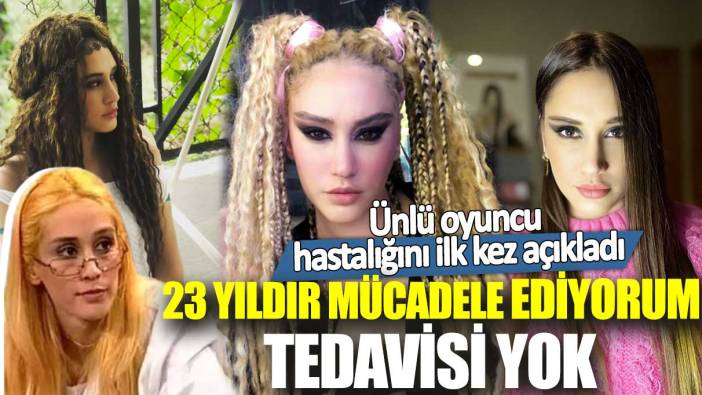 Oyuncu Zeynep Koçak hastalığını ilk kez açıkladı! 23 yıldır mücadele ediyorum tedavisi yok