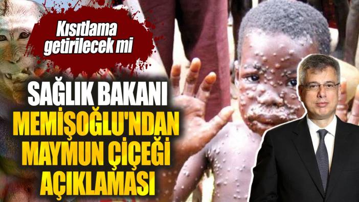 Sağlık Bakanı Memişoğlu'ndan maymun çiçeği açıklaması! Kısıtlama getirilecek mi?