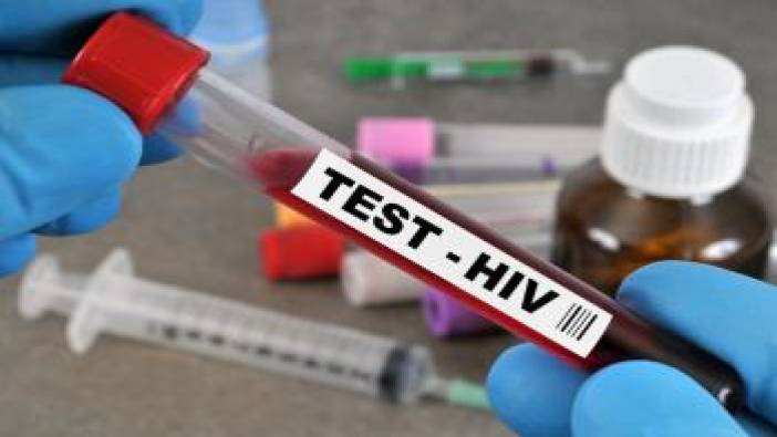 Korkunç tablo! HIV çocuklarda ve kadınlarda rekor seviyede arttı