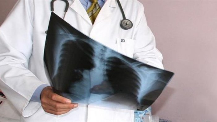 Akciğer kanseri görülme sıklığı hem dünyada hem de Türkiye'de artıyor
