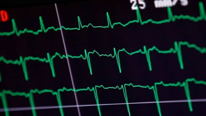 EKG sonuçlarına göre ölüm zamanı belirlenecek!