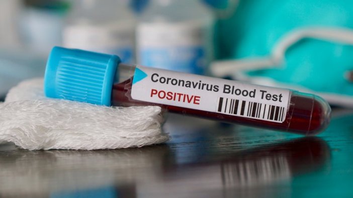 Tunus'ta ilk Coronavirüs vakası!